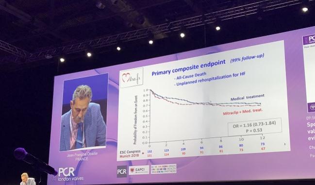 MITRA-FR in the Hot Seat as Experts Debate Impact on Guidelines and Practice